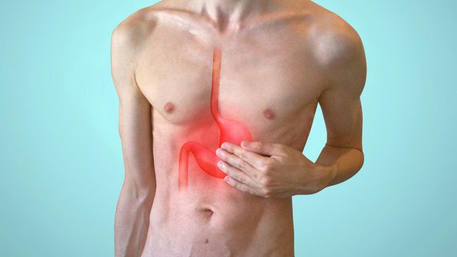 Stres Picu GERD & Asam Lambung Kambuh, Mitos atau Fakta?